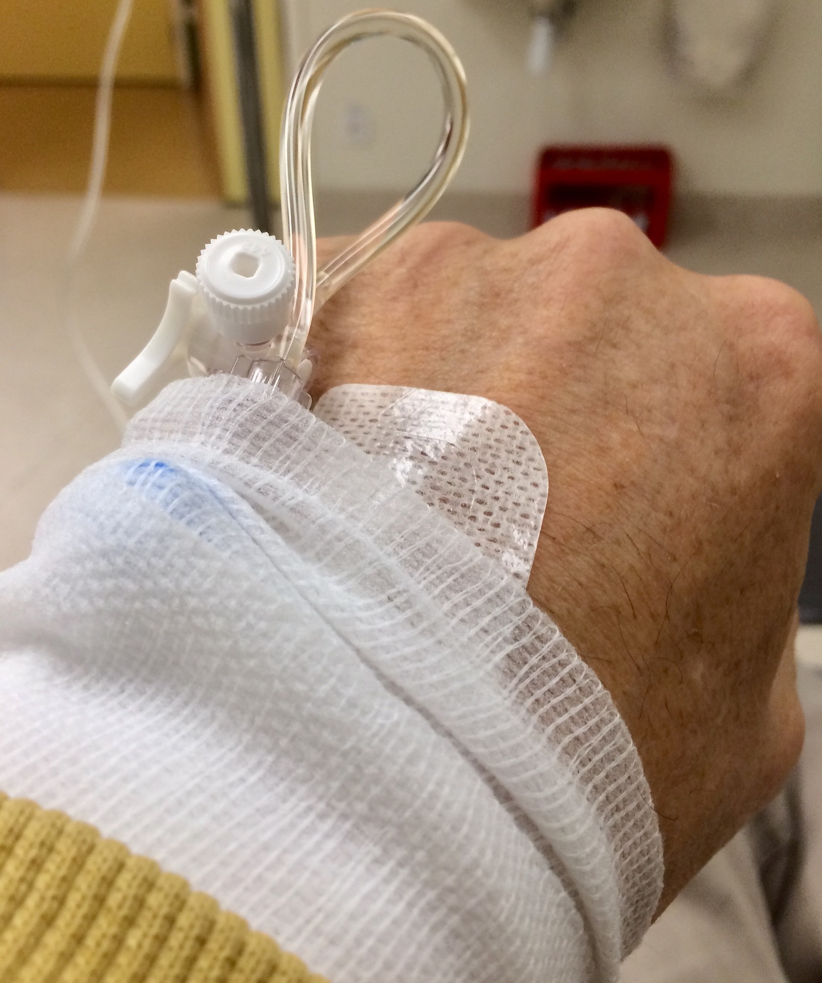 shows a man's hand with cannula for a drip